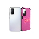 Redmi Note 11 Pro Ladies Funcy Pouch Mobile Pouch (Pink)